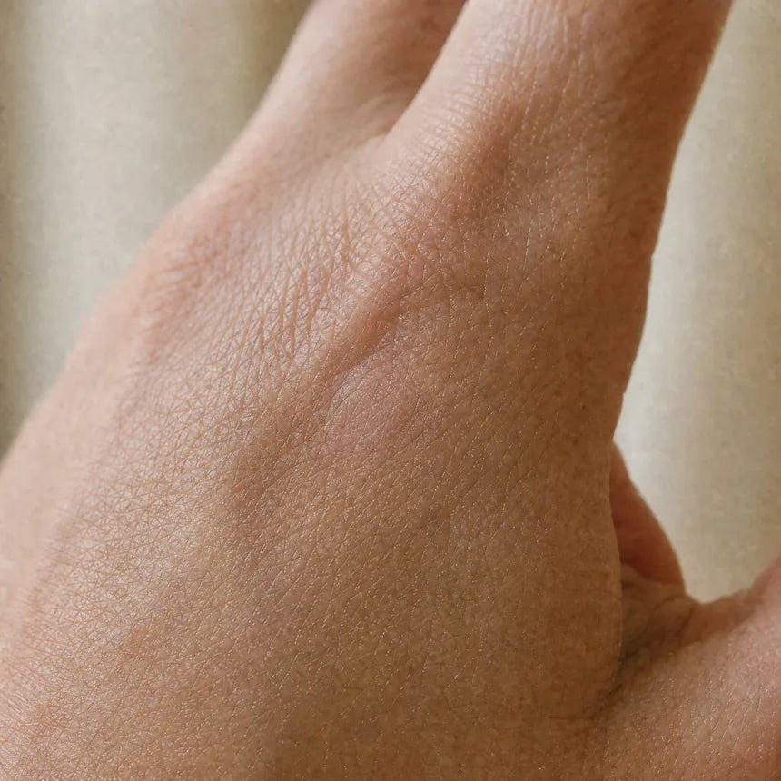 The same hand, clear, two weeks later