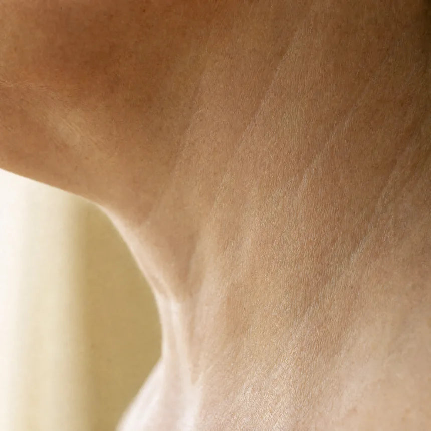 The same spot on the neck, clear, two weeks later